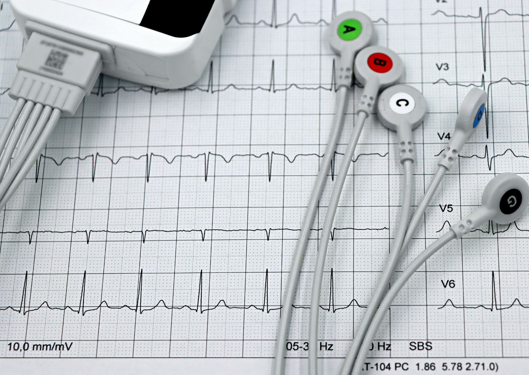 30. März 2026 // Hagen // Vom Biosignal zur Diagnose: Entdecke die Medizintechnik